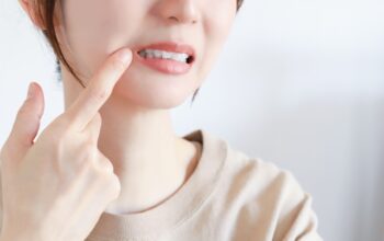 歯を気にしている女性